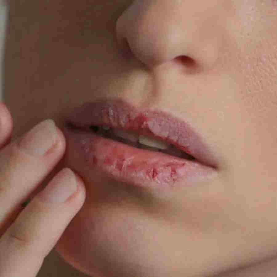 Health Tips black spots on the lips instead of smoking