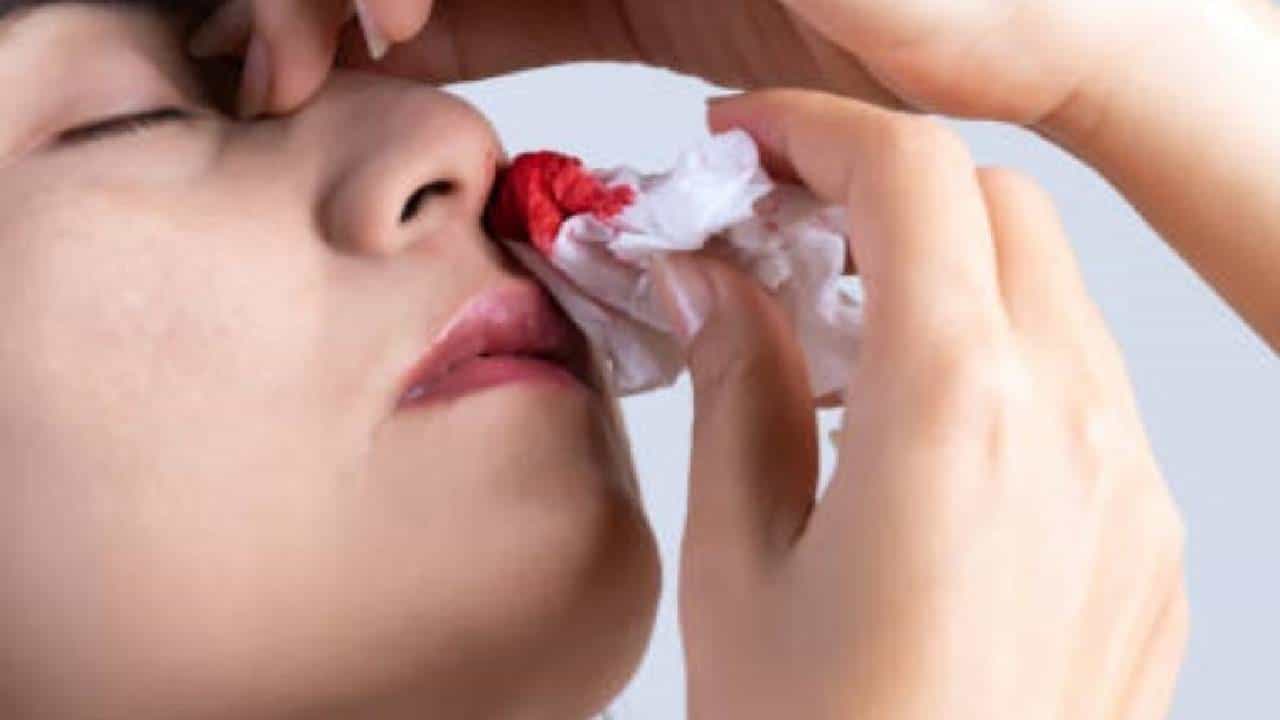 Bleeding Nose: ಆಗಾಗ ಮೂಗಿನಿಂದ ರಕ್ತಸ್ರಾವವಾಗುತ್ತಾ? ಸಮಸ್ಯೆ ನಿವಾರಣೆಗೆ ಹೀಗೆ ಮಾಡಿ Bleeding Nose: ಆಗಾಗ ಮೂಗಿನಿಂದ ರಕ್ತಸ್ರಾವವಾಗುತ್ತಾ? ಸಮಸ್ಯೆ ನಿವಾರಣೆಗೆ ಹೀಗೆ ಮಾಡಿ