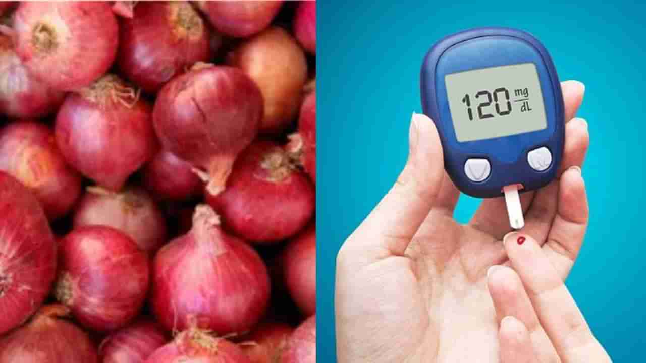 Diabetes: ರಕ್ತದಲ್ಲಿರುವ ಸಕ್ಕರೆ ಮಟ್ಟವನ್ನು ಶೇ.50ರಷ್ಟು ತಗ್ಗಿಸುತ್ತೆ ಈರುಳ್ಳಿ