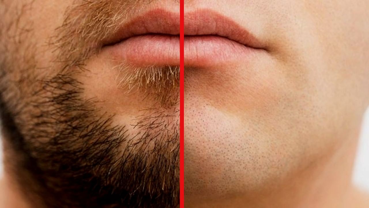 Clean Shave: ಗಡ್ಡ ಬಿಡುವುದು ಮೂಲಭೂತ ಹಕ್ಕಲ್ಲ, ಪೊಲೀಸ್ ಶಿಷ್ಟಾಚಾರಕ್ಕೆ ತಕ್ಕಂತೆ ಗಡ್ಡ ತೆಗೆಯಬೇಕು -ಹೈಕೋರ್ಟ್ Clean Shave: ಗಡ್ಡ ಬಿಡುವುದು ಮೂಲಭೂತ ಹಕ್ಕಲ್ಲ, ಪೊಲೀಸ್ ಶಿಷ್ಟಾಚಾರಕ್ಕೆ ತಕ್ಕಂತೆ ಗಡ್ಡ ತೆಗೆಯಬೇಕು -ಹೈಕೋರ್ಟ್