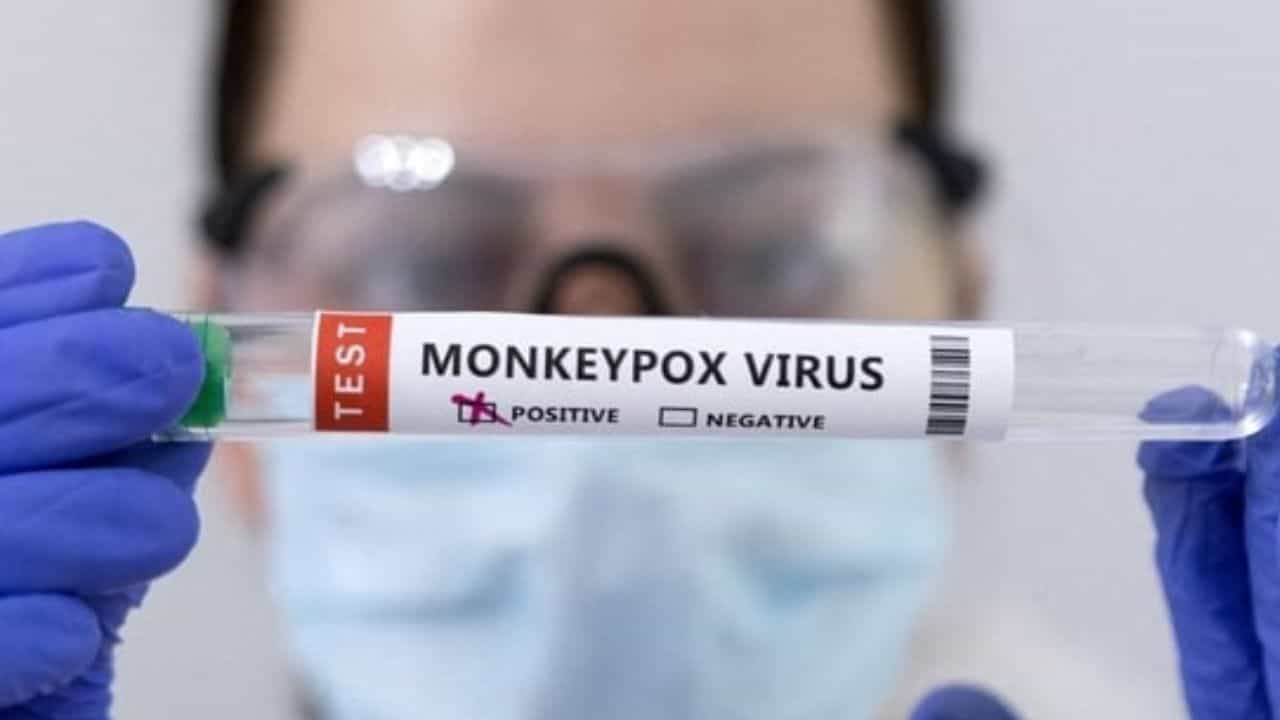 Monkeypox Cases: ಜಾಗತಿಕವಾಗಿ 50,000 ಮಂಕಿಪಾಕ್ಸ್ ಪ್ರಕರಣಗಳು ಪತ್ತೆ; WHO Monkeypox Cases: ಜಾಗತಿಕವಾಗಿ 50,000 ಮಂಕಿಪಾಕ್ಸ್ ಪ್ರಕರಣಗಳು ಪತ್ತೆ; WHO