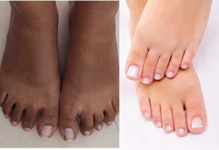 Foot Tanning: ಪಾದಗಳು ಕಪ್ಪಾಗುತ್ತಿವೆಯೇ?, ಈ ಸುಲಭ ಮನೆಮದ್ದುಗಳನ್ನು ಬಳಸಿ, ಕಪ್ಪುತನವನ್ನು ಹೋಗಲಾಡಿಸಿ Foot Tanning: ಪಾದಗಳು ಕಪ್ಪಾಗುತ್ತಿವೆಯೇ?, ಈ ಸುಲಭ ಮನೆಮದ್ದುಗಳನ್ನು ಬಳಸಿ, ಕಪ್ಪುತನವನ್ನು ಹೋಗಲಾಡಿಸಿ
