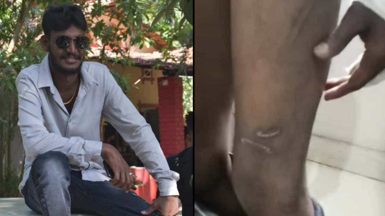 ಪೊಲೀಸರಿಂದ ದಲಿತ ಯುವಕನಿಗೆ ಕಿರುಕುಳ ಆರೋಪ: ಹೈಕೋರ್ಟ್ ಮುಖ್ಯ ನ್ಯಾಯಮೂರ್ತಿಗೆ ಪತ್ರ ಪೊಲೀಸರಿಂದ ದಲಿತ ಯುವಕನಿಗೆ ಕಿರುಕುಳ ಆರೋಪ: ಹೈಕೋರ್ಟ್ ಮುಖ್ಯ ನ್ಯಾಯಮೂರ್ತಿಗೆ ಪತ್ರ