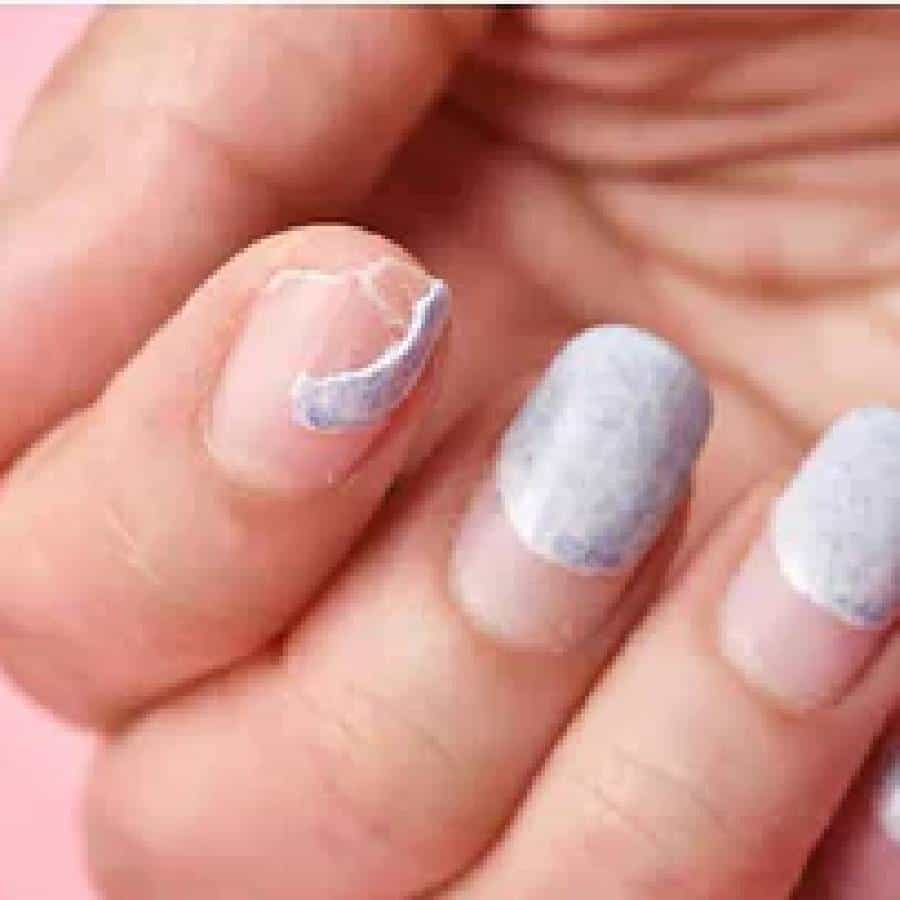 ದುರ್ಬಲವಾದ ಉಗುರುಗಳು(Brittle nails): ಪೋಷಣೆಯ ಕೊರತೆ, ವಿಟಮಿನ್ ಎ, ಸಿ ಕೊರತೆವು ದುರ್ಬಲವಾದ ಉಗುರುಗಳಿಗೆ ಕಾರಣವಾಗುತ್ತದೆ. ಇಂತಹ ಉಗುರುಗಳು ತುಂಬಾ ಮೃದುವಾಗಿದ್ದು ಬೇಗ ಮುರಿಯುವ ಸಾಧ್ಯತೆ ಇದೆ.