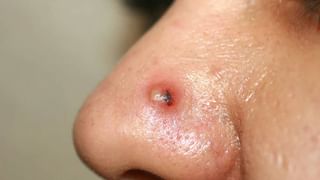 World Smile Day 2022: ನಗು ನಿಮ್ಮ ಮಾನಸಿಕ-ದೈಹಿಕ ಆರೋಗ್ಯವನ್ನು ಎರಡೂವರೆ ಪಟ್ಟು ಸುಧಾರಿಸುತ್ತೆ