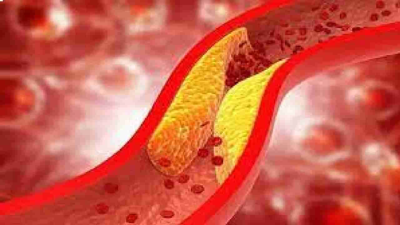 Cholesterol: ದೇಹದಲ್ಲಿ ಒಳ್ಳೆಯ ಕೊಲೆಸ್ಟ್ರಾಲ್ ಹೆಚ್ಚಿಸಲು ಈ ಆಹಾರಗಳನ್ನು ಸೇವಿಸಿ