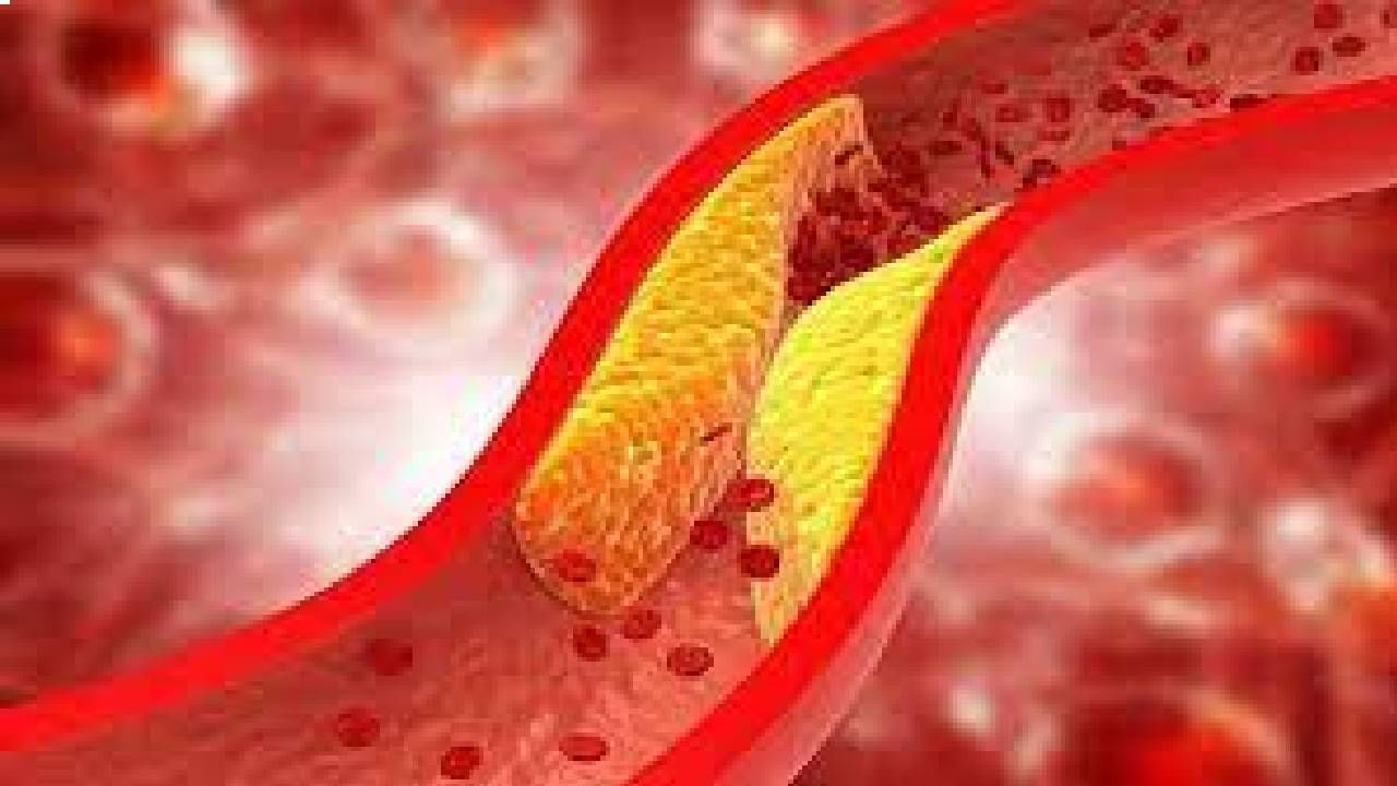 Cholesterol: ದೇಹದಲ್ಲಿ ಒಳ್ಳೆಯ ಕೊಲೆಸ್ಟ್ರಾಲ್ ಹೆಚ್ಚಿಸಲು ಈ ಆಹಾರಗಳನ್ನು ಸೇವಿಸಿ Cholesterol: ದೇಹದಲ್ಲಿ ಒಳ್ಳೆಯ ಕೊಲೆಸ್ಟ್ರಾಲ್ ಹೆಚ್ಚಿಸಲು ಈ ಆಹಾರಗಳನ್ನು ಸೇವಿಸಿ