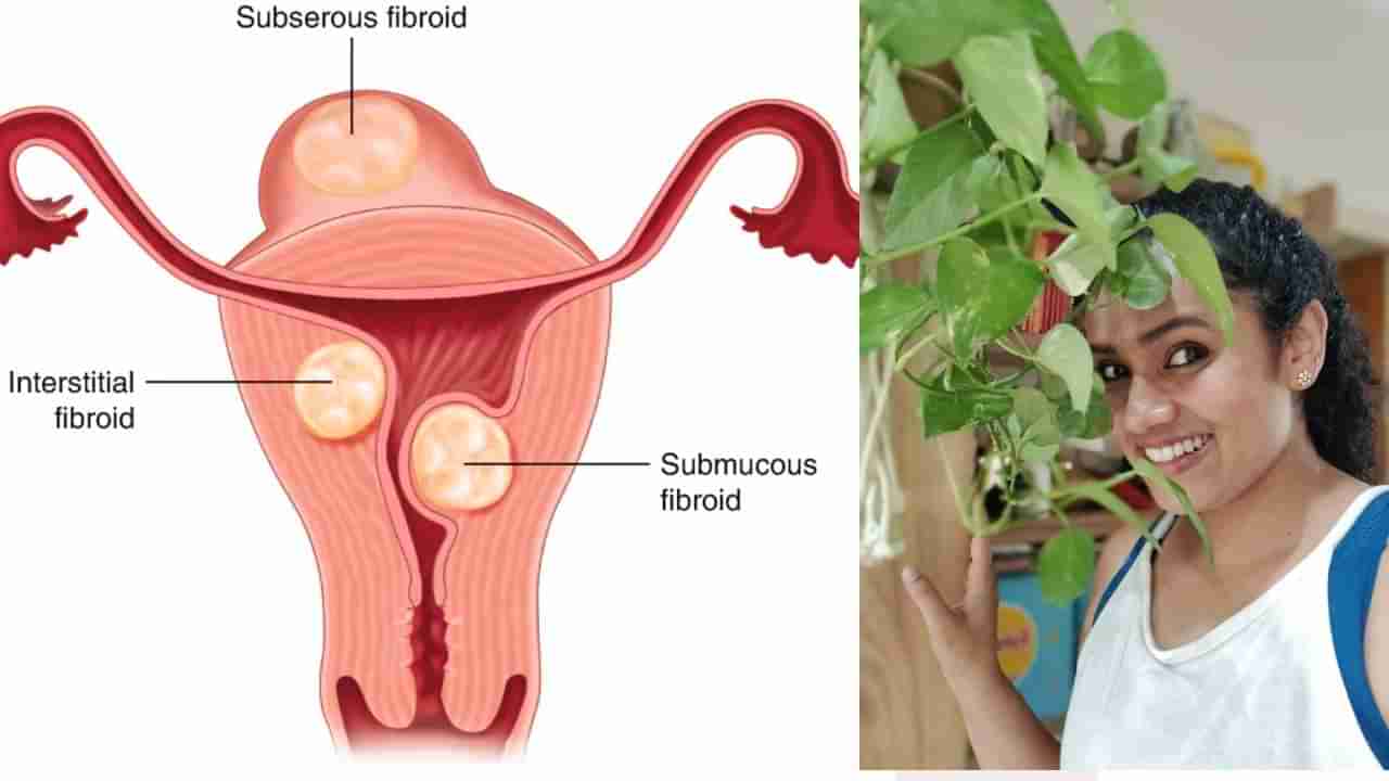 Fibroids: ಗರ್ಭಾಶಯ ಫೈಬ್ರಾಯ್ಡ್​ ಸಮಸ್ಯೆಯನ್ನು ಕಡಿಮೆ ಮಾಡಲು ಈ ಯೋಗಾಸನಗಳು ನಿಮಗೆ ಸಹಕಾರಿ