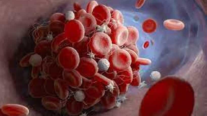 Blood Clots: ರಕ್ತ ಹೆಪ್ಪುಗಟ್ಟುವಿಕೆ ಸಮಸ್ಯೆ ಸುಲಭವಾಗಿ ದೂರ ಮಾಡಲು ಈ ಹಣ್ಣುಗಳು ಸಹಕಾರಿ