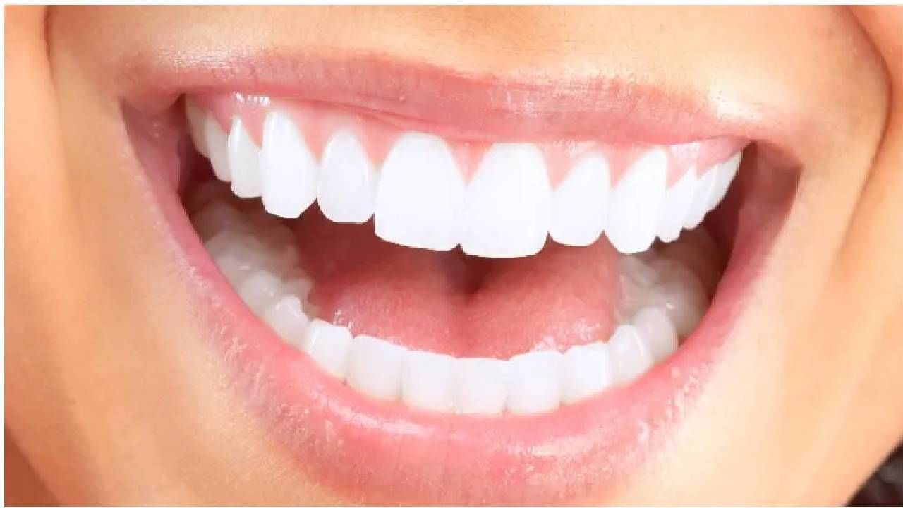 Teeth Astrology: ನಿಮ್ಮ ಹಲ್ಲುಗಳು ನೀವು ಇತರರಿಗಿಂತ ಹೇಗೆ ಭಿನ್ನವೆಂಬುದನ್ನು ವಿವರಿಸುತ್ತವೆ ಹೇಗೆ? ಇಲ್ಲಿದೆ ಮಾಹಿತಿ Teeth Astrology: ನಿಮ್ಮ ಹಲ್ಲುಗಳು ನೀವು ಇತರರಿಗಿಂತ ಹೇಗೆ ಭಿನ್ನವೆಂಬುದನ್ನು ವಿವರಿಸುತ್ತವೆ ಹೇಗೆ? ಇಲ್ಲಿದೆ ಮಾಹಿತಿ