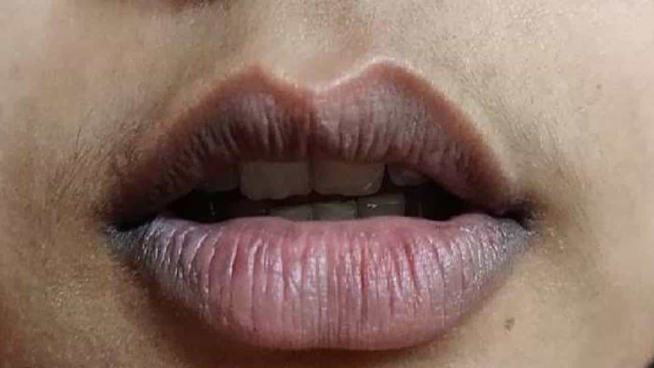 Dark Lips: ನಿಮ್ಮ ತುಟಿಯ ಬಣ್ಣ ಕಪ್ಪಾಗುತ್ತಿದ್ದರೆ ಅದಕ್ಕೆ ಕಾರಣ ಹಾಗೂ ಪರಿಹಾರ ಇಲ್ಲಿದೆ Dark Lips: ನಿಮ್ಮ ತುಟಿಯ ಬಣ್ಣ ಕಪ್ಪಾಗುತ್ತಿದ್ದರೆ ಅದಕ್ಕೆ ಕಾರಣ ಹಾಗೂ ಪರಿಹಾರ ಇಲ್ಲಿದೆ