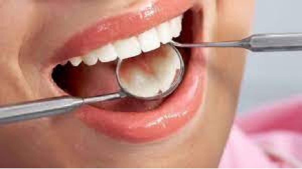 Dental Care: ಈ ಆಹಾರಗಳನ್ನು ಸೇವಿಸುವುದರಿಂದ ನಿಮ್ಮ ಹಲ್ಲುಗಳಿಗೆ ಹಾನಿಯಾಗಬಹುದು ಎಚ್ಚರ Dental Care: ಈ ಆಹಾರಗಳನ್ನು ಸೇವಿಸುವುದರಿಂದ ನಿಮ್ಮ ಹಲ್ಲುಗಳಿಗೆ ಹಾನಿಯಾಗಬಹುದು ಎಚ್ಚರ