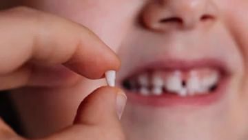 Milk Teeth: ಮಕ್ಕಳು ಹಲ್ಲು ನುಂಗಿದರೆ ಏನಾಗುತ್ತೆ? ಎಲ್ಲಾ ಪೋಷಕರಿಗಿರುವ ಆತಂಕ ನಿಮಗೂ ಇದೆಯಾ?