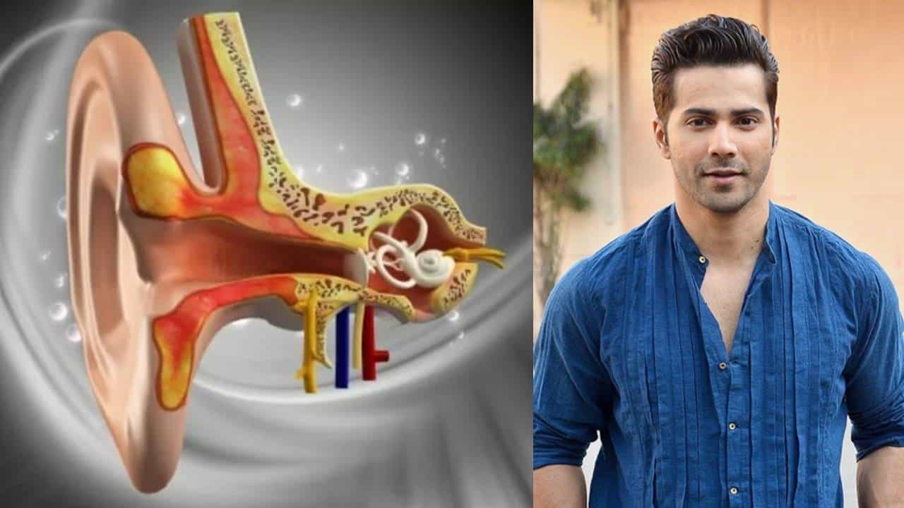 Vestibular Hypofunction: ವೆಸ್ಟಿಬುಲರ್ ಹೈಪೋಫಂಕ್ಷನ್ ಎಂದರೇನು? ನಟ ವರುಣ್ ಧವನ್ ಈ ಕಾಯಿಲೆಯಿಂದ ಬಳಲುತ್ತಿರುವುದು ನಿಜನಾ? Vestibular Hypofunction: ವೆಸ್ಟಿಬುಲರ್ ಹೈಪೋಫಂಕ್ಷನ್ ಎಂದರೇನು? ನಟ ವರುಣ್ ಧವನ್ ಈ ಕಾಯಿಲೆಯಿಂದ ಬಳಲುತ್ತಿರುವುದು ನಿಜನಾ?