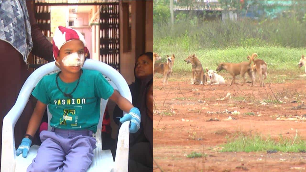 ಶಿಡ್ಲಘಟ್ಟ: ಆಡುತ್ತಿದ್ದ ಬಾಲಕನನ್ನು ಕಚ್ಚಿ ಗಾಯಗೊಳಿಸಿದ ಬೀದಿನಾಯಿಗಳು, ನಗರಸಭೆ ಎದುರು ಜನರೊಂದಿಗೆ ಧರಣಿ ಕುಳಿತ ಪುಟಾಣಿ ಶಿಡ್ಲಘಟ್ಟ: ಆಡುತ್ತಿದ್ದ ಬಾಲಕನನ್ನು ಕಚ್ಚಿ ಗಾಯಗೊಳಿಸಿದ ಬೀದಿನಾಯಿಗಳು, ನಗರಸಭೆ ಎದುರು ಜನರೊಂದಿಗೆ ಧರಣಿ ಕುಳಿತ ಪುಟಾಣಿ
