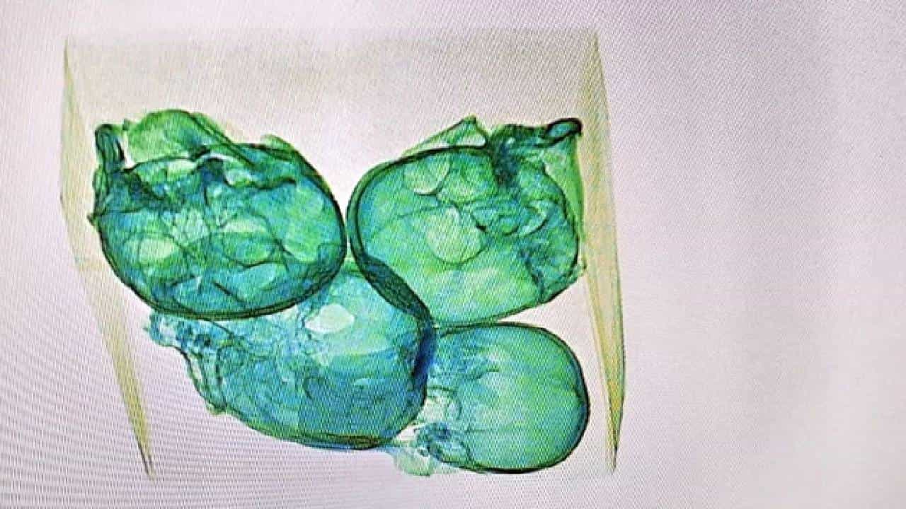 Four Human Skulls: ವಿಮಾನ ನಿಲ್ದಾಣದಲ್ಲಿ ಅಲ್ಯೂಮಿನಿಯಂ ಫಾಯಿಲ್ನಲ್ಲಿ ಸುತ್ತಿದ 4 ತಲೆಬುರುಡೆ ಪತ್ತೆ Four Human Skulls: ವಿಮಾನ ನಿಲ್ದಾಣದಲ್ಲಿ ಅಲ್ಯೂಮಿನಿಯಂ ಫಾಯಿಲ್ನಲ್ಲಿ ಸುತ್ತಿದ 4 ತಲೆಬುರುಡೆ ಪತ್ತೆ