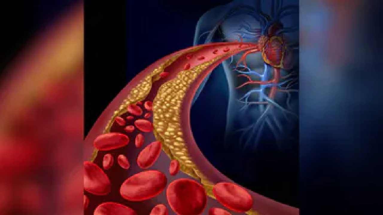 Cholesterol: ದೇಹದ ಕೊಬ್ಬು ಕರಗಿಸುವ ಅದ್ಭುತ 5 ಪಾನೀಯಗಳಿವು Cholesterol: ದೇಹದ ಕೊಬ್ಬು ಕರಗಿಸುವ ಅದ್ಭುತ 5 ಪಾನೀಯಗಳಿವು