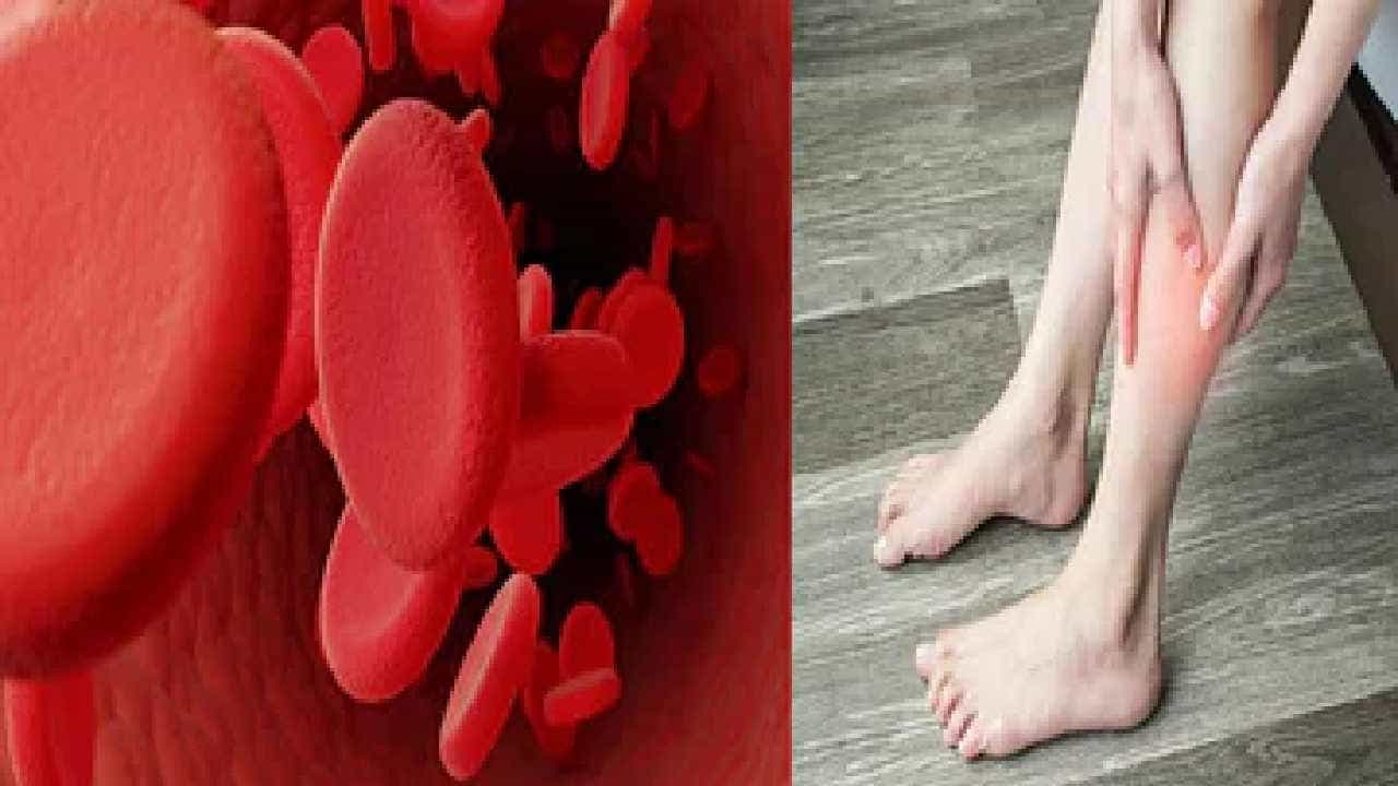 Blood Clot: ರಕ್ತ ಹೆಪ್ಪುಗಟ್ಟುವಿಕೆಯು, ನಿಮ್ಮ ಜೀವವನ್ನೇ ಕಸಿಯಬಹುದು, ಈ ಲಕ್ಷಣಗಳಿದ್ದರೆ ತಪಾಸಣೆ ಅಗತ್ಯ Blood Clot: ರಕ್ತ ಹೆಪ್ಪುಗಟ್ಟುವಿಕೆಯು, ನಿಮ್ಮ ಜೀವವನ್ನೇ ಕಸಿಯಬಹುದು, ಈ ಲಕ್ಷಣಗಳಿದ್ದರೆ ತಪಾಸಣೆ ಅಗತ್ಯ