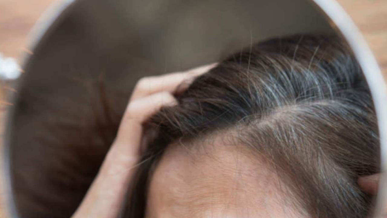 White Hair Problem: ತಲೆಯ ಬಿಳಿ ಕೂದಲನ್ನು ಕೃತಕ ಬಣ್ಣ ಬಳಸದೆ ನೈಸರ್ಗಿಕವಾಗಿ ಕಪ್ಪುಗೊಳಿಸಲು ಇಲ್ಲಿದೆ ಮನೆ ಮದ್ದು White Hair Problem: ತಲೆಯ ಬಿಳಿ ಕೂದಲನ್ನು ಕೃತಕ ಬಣ್ಣ ಬಳಸದೆ ನೈಸರ್ಗಿಕವಾಗಿ ಕಪ್ಪುಗೊಳಿಸಲು ಇಲ್ಲಿದೆ ಮನೆ ಮದ್ದು