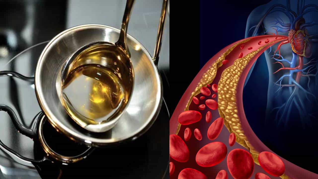 Healthy Oils: ಚಳಿಗಾಲದಲ್ಲಿ ಕರಿದ ಆಹಾರ ತಿನ್ನುವ ಆಸೆಯೇ? ಆದರೆ ಹೈ ಕೊಲೆಸ್ಟ್ರಾಲ್ ಇದೆ, ಹೀಗೆ ಮಾಡಿ Healthy Oils: ಚಳಿಗಾಲದಲ್ಲಿ ಕರಿದ ಆಹಾರ ತಿನ್ನುವ ಆಸೆಯೇ? ಆದರೆ ಹೈ ಕೊಲೆಸ್ಟ್ರಾಲ್ ಇದೆ, ಹೀಗೆ ಮಾಡಿ