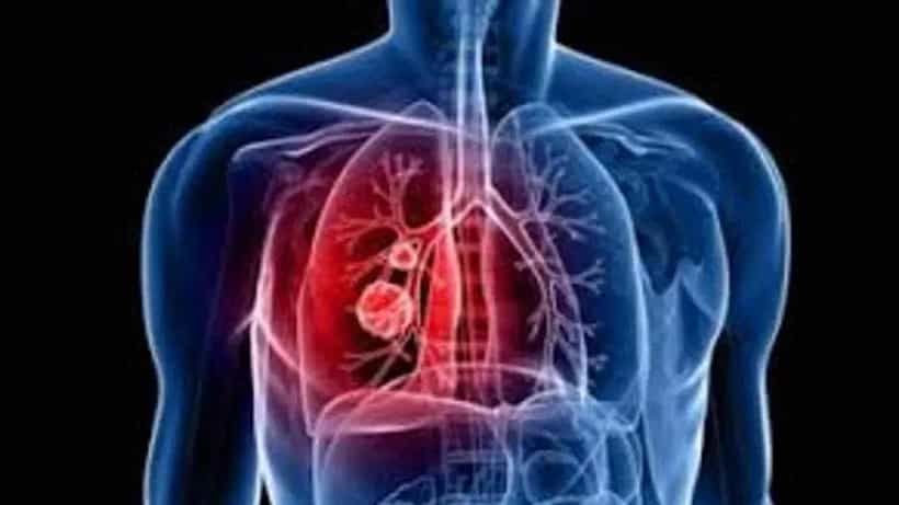 Winter Diet For Lungs: ಚಳಿಗಾಲದಲ್ಲಿ ನಿಮ್ಮ ಶ್ವಾಸಕೋಶದ ಆರೋಗ್ಯವನ್ನು ಕಾಪಾಡುವ ಬೆಸ್ಟ್ 7 ಆಹಾರಗಳು ಇಲ್ಲಿವೆ