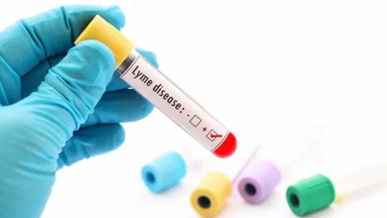 Lyme Disease: ಲೈಮ್ ಕಾಯಿಲೆಯು ಮಾನಸಿಕ ಅಸ್ವಸ್ಥತೆ, ಆತ್ಮಹತ್ಯೆ ಅಪಾಯ ಹೆಚ್ಚಿಸುತ್ತದೆ: ಅಧ್ಯಯನ Lyme Disease: ಲೈಮ್ ಕಾಯಿಲೆಯು ಮಾನಸಿಕ ಅಸ್ವಸ್ಥತೆ, ಆತ್ಮಹತ್ಯೆ ಅಪಾಯ ಹೆಚ್ಚಿಸುತ್ತದೆ: ಅಧ್ಯಯನ