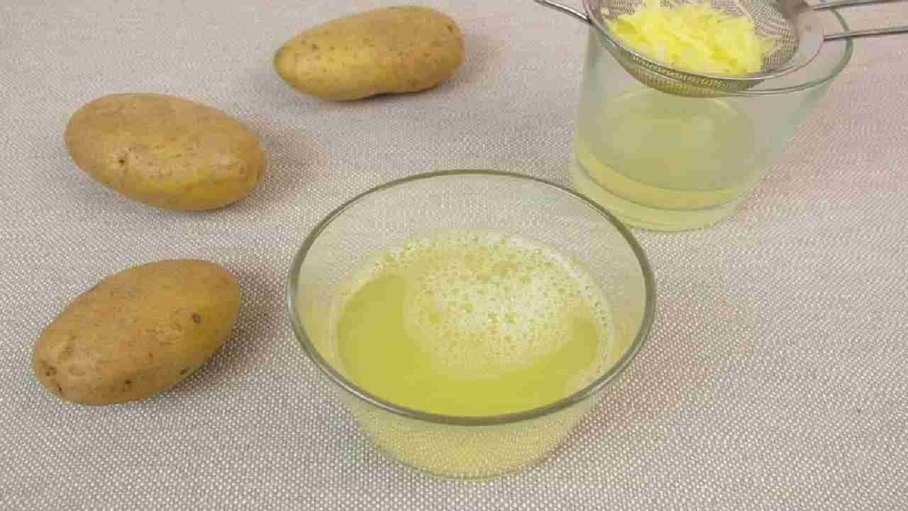 Potato juice: ಆಲೂಗಡ್ಡೆ ಜ್ಯೂಸ್ ಈ ಗಂಭೀರ ಸಮಸ್ಯೆಗಳಿಗೆ ಪರಿಹಾರ