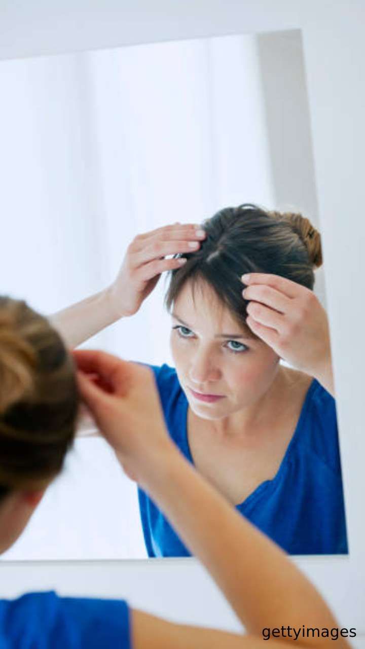 dry dandruff