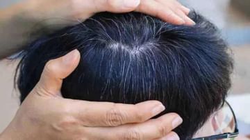 White Hair: Due to the deficiency of this vitamin, premature graying of hair occurs, eat these things to avoid it | White Hair: ಈ ವಿಟಮಿನ್ ಕೊರತೆಯುಂಟಾದರೆ ಅವಧಿಗೂ ಮುನ್ನವೇ ಕೂದಲು ಬಿಳಿಯಾಗುವುದು| TV9 Kannada White Hair: Due to the deficiency of this vitamin, premature graying of hair occurs, eat these things to avoid it | White Hair: ಈ ವಿಟಮಿನ್ ಕೊರತೆಯುಂಟಾದರೆ ಅವಧಿಗೂ ಮುನ್ನವೇ ಕೂದಲು ಬಿಳಿಯಾಗುವುದು| TV9 Kannada