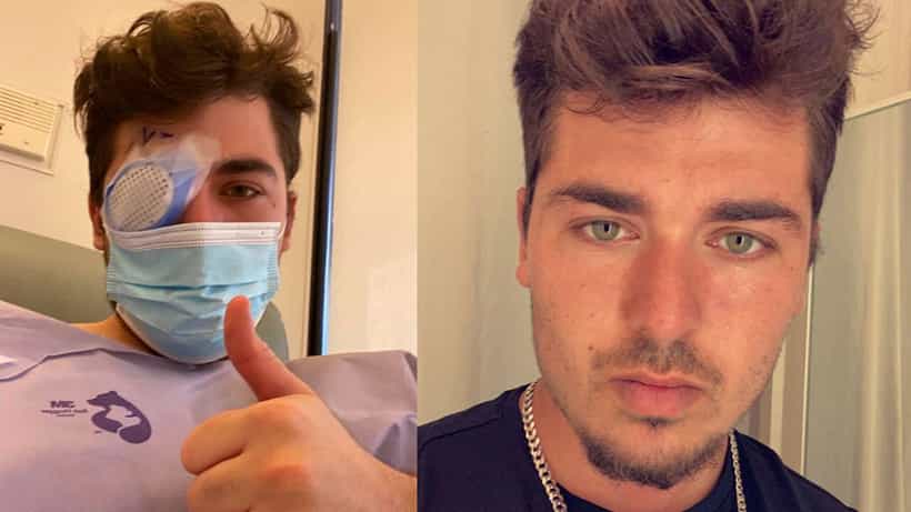 Eye Infections: ಕಾಂಟ್ಯಾಕ್ಟ್ ಲೆನ್ಸ್ಗಳನ್ನು ಧರಿಸುವ ಪ್ರತಿಯೊಬ್ಬರೂ ತಿಳಿದುಕೊಳ್ಳಬೇಕಾದ ಸಂಗತಿ ಇಲ್ಲಿದೆ
