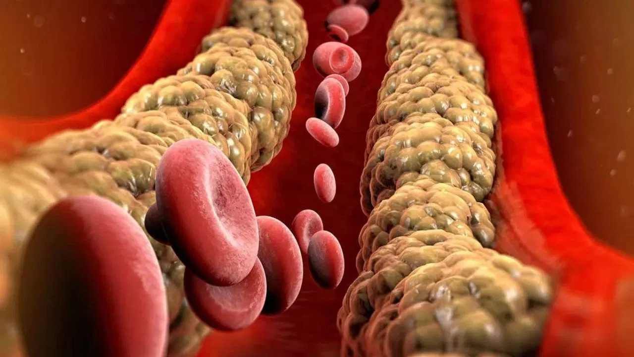 Cholesterol side effects 