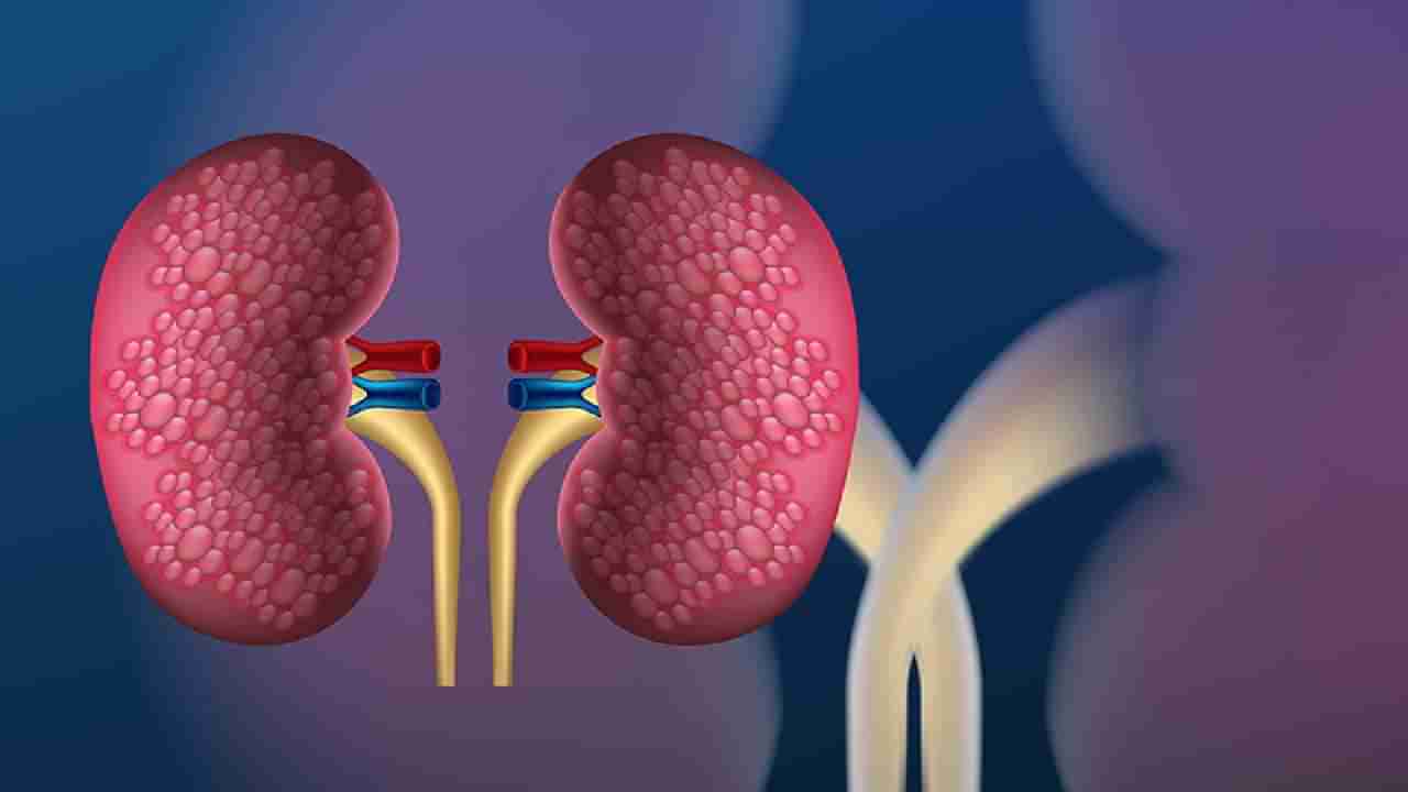 Diabetic Kidney Disease: ಮಧುಮೇಹ ಕಿಡ್ನಿ ಕಾಯಿಲೆಯ ಲಕ್ಷಣ ಮತ್ತು ಚಿಕಿತ್ಸೆಯ ಕುರಿತು ಮಾಹಿತಿ ಇಲ್ಲಿದೆ