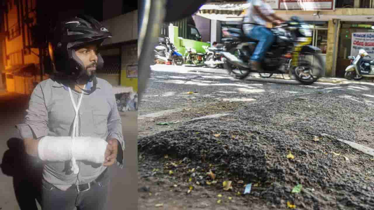 ಅವೈಜ್ಞಾನಿಕ ಹಂಪ್ ಗೆ ಬಿದ್ದು ಕೈ ಮುರಿದುಕೊಂಡ ಬೈಕ್ ಸವಾರ; ಸಾಮಾಜಿಕ ಜಾಲತಾಣದಲ್ಲಿ ಬಿಬಿಎಂಪಿ ಹಾಗೂ ಸಂಚಾರಿ ಪೊಲೀಸರ ವಿರುದ್ಧ ಆಕ್ರೋಶ