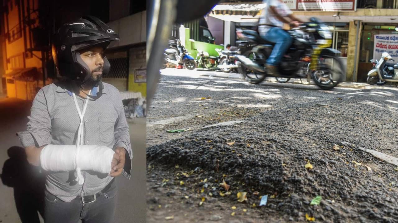 ಅವೈಜ್ಞಾನಿಕ ಹಂಪ್ ಗೆ ಬಿದ್ದು ಕೈ ಮುರಿದುಕೊಂಡ ಬೈಕ್ ಸವಾರ; ಸಾಮಾಜಿಕ ಜಾಲತಾಣದಲ್ಲಿ ಬಿಬಿಎಂಪಿ ಹಾಗೂ ಸಂಚಾರಿ ಪೊಲೀಸರ ವಿರುದ್ಧ ಆಕ್ರೋಶ ಅವೈಜ್ಞಾನಿಕ ಹಂಪ್ ಗೆ ಬಿದ್ದು ಕೈ ಮುರಿದುಕೊಂಡ ಬೈಕ್ ಸವಾರ; ಸಾಮಾಜಿಕ ಜಾಲತಾಣದಲ್ಲಿ ಬಿಬಿಎಂಪಿ ಹಾಗೂ ಸಂಚಾರಿ ಪೊಲೀಸರ ವಿರುದ್ಧ ಆಕ್ರೋಶ