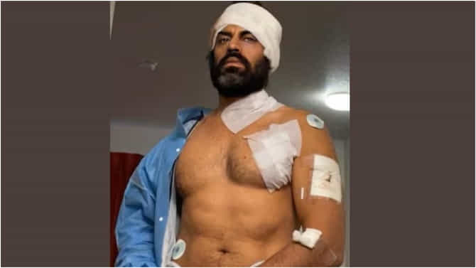 Aman Dhaliwal: ಪಂಜಾಬಿ ನಟ ಅಮನ್​ ಧಾಲಿವಾಲ್​ ಮೇಲೆ ಮಾರಣಾಂತಿಕ ಹಲ್ಲೆ; ವಿಡಿಯೋ ವೈರಲ್​