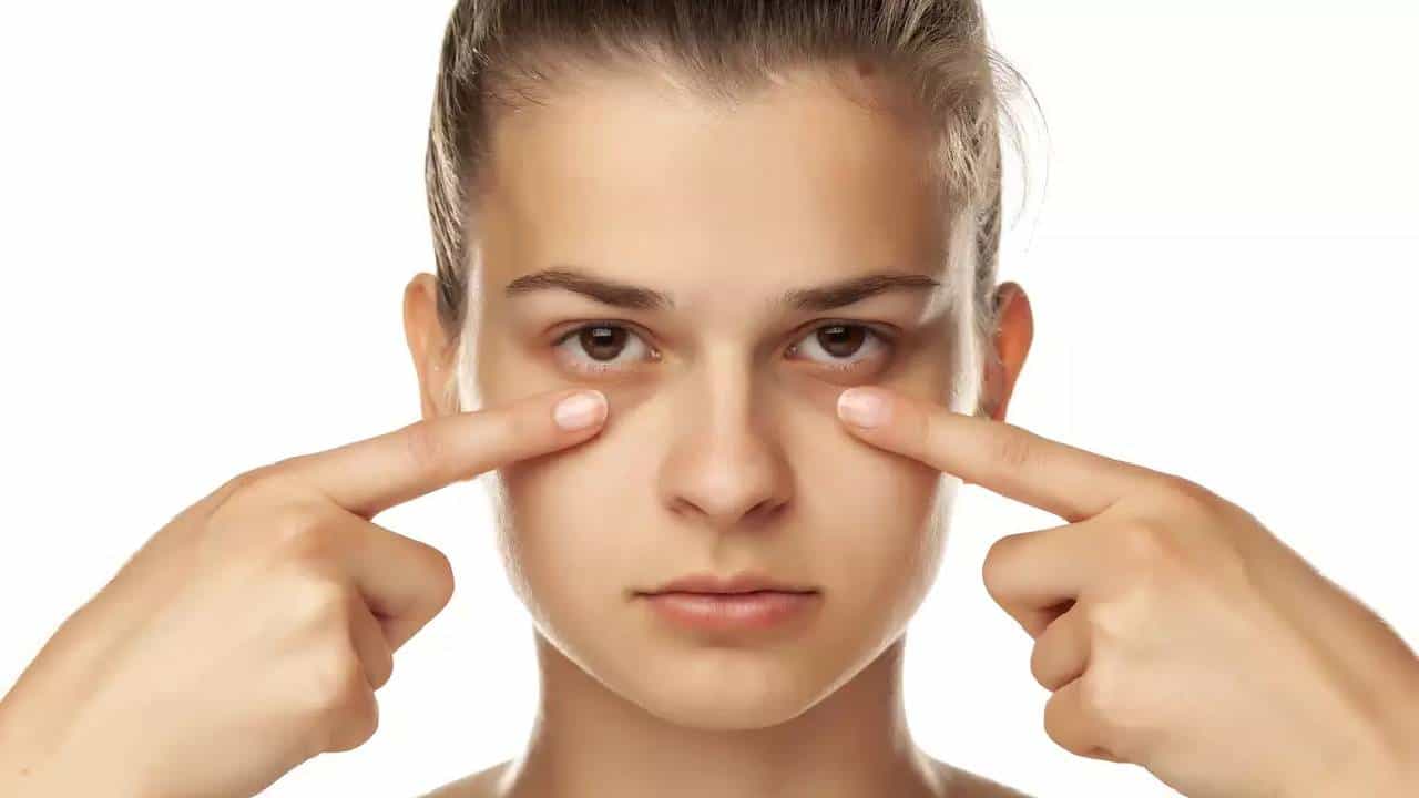 Dark Circles: ಡಾರ್ಕ್ ಸರ್ಕಲ್ಸ್​ ಬರಲು ಕಾರಣವೇನು? ಜೀವನಶೈಲಿಯೋ..ಅನುವಂಶಿಕ ಸಮಸ್ಯೆಯೋ?