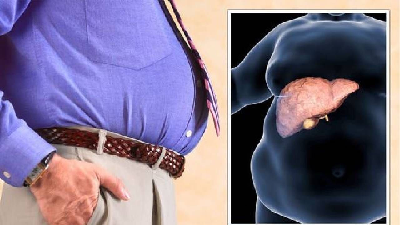 Fatty Liver Disease: ಕೊಬ್ಬಿನ ಪಿತ್ತಜನಕಾಂಗದ ಕಾಯಿಲೆ ಹೋಗಲಾಡಿಸಲು 5 ಆಹಾರ ಮತ್ತು ಜೀವನಶೈಲಿ ಸಲಹೆ