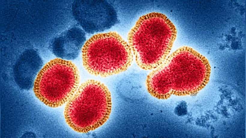 H3N2 Death in Maharashtra: ಮಹಾರಾಷ್ಟ್ರದಲ್ಲಿ ತೀವ್ರ ಜ್ವರದಿಂದ ಎಂಬಿಬಿಎಸ್ ವಿದ್ಯಾರ್ಥಿ ಸಾವು, ಹೆಚ್3ಎನ್2 ವೈರಸ್ ಶಂಕೆ