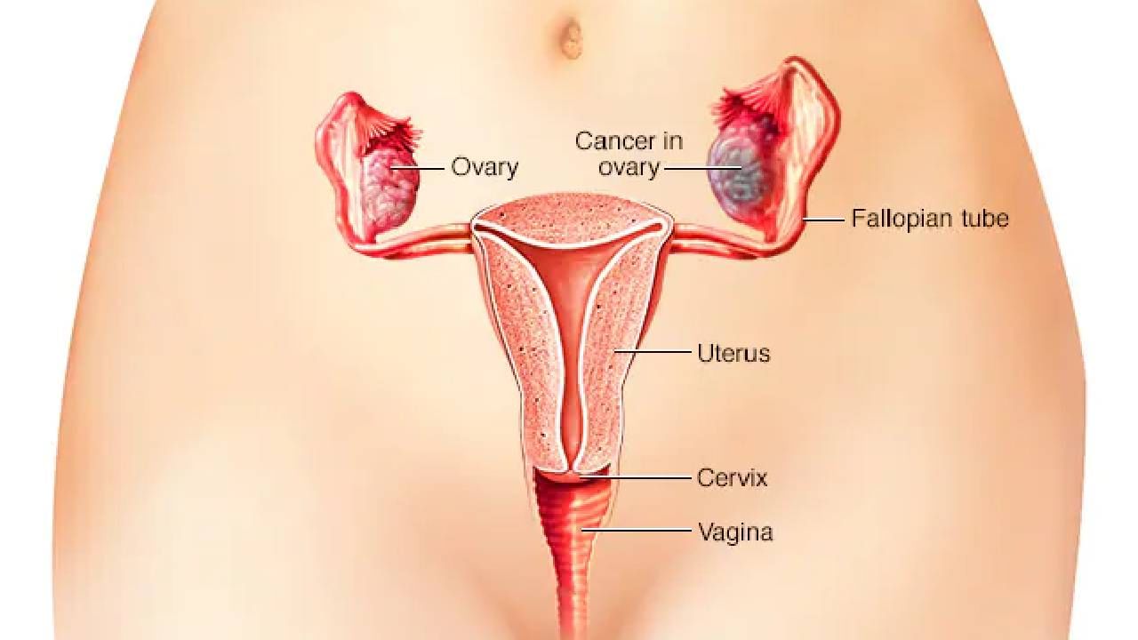 Women's Health: ಮಹಿಳೆಯರಲ್ಲಿ ಈ ಲಕ್ಷಣಗಳು ಕ್ಯಾನ್ಸರ್ನ ಆರಂಭಿಕ ಚಿಹ್ನೆಗಳಾಗಿರಬಹುದು