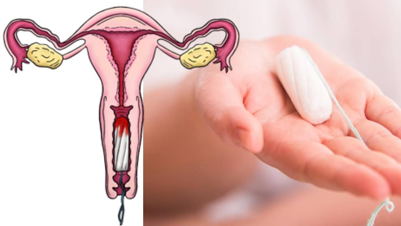 Women Health: ಟ್ಯಾಂಪೂನ್‌ ಬಳಸುವ ವಿಧಾನ, ಇದು ಸ್ಯಾನಿಟರ್​​​ ಪ್ಯಾಡ್‌ಗಿಂತ ಹೇಗೆ ಭಿನ್ನ ಹಾಗೂ ಎಷ್ಟು ಸುರಕ್ಷಿತ? ಇಲ್ಲಿದೆ ಮಾಹಿತಿ