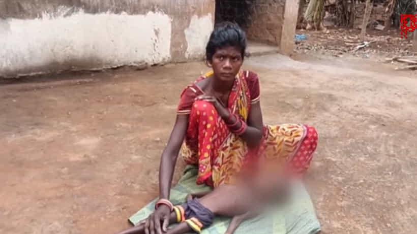 ಒಡಿಶಾದ ಜಾಜ್ಪುರ್ ಜಿಲ್ಲೆಯಲ್ಲಿ ಅಪೌಷ್ಟಿಕತೆಯಿಂದ ಮಗು ಸಾವು; ಅನ್ನ, ಉಪ್ಪು ಮತ್ತು ನೀರು ಸೇವಿಸಿಯೇ ಬದುಕುತ್ತಿದೆ ಕುಟುಂಬ