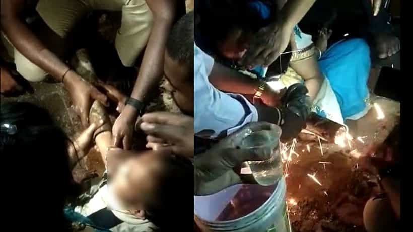 ಆಡುತ್ತಿದ್ದಾಗ ಕಬ್ಬಿಣದ ಪೈಪ್ ಒಳಗೆ ಸಿಲುಕಿದ ಒಂದೂವರೆ ವರ್ಷದ ಮಗುವಿನ ಕೈ!
