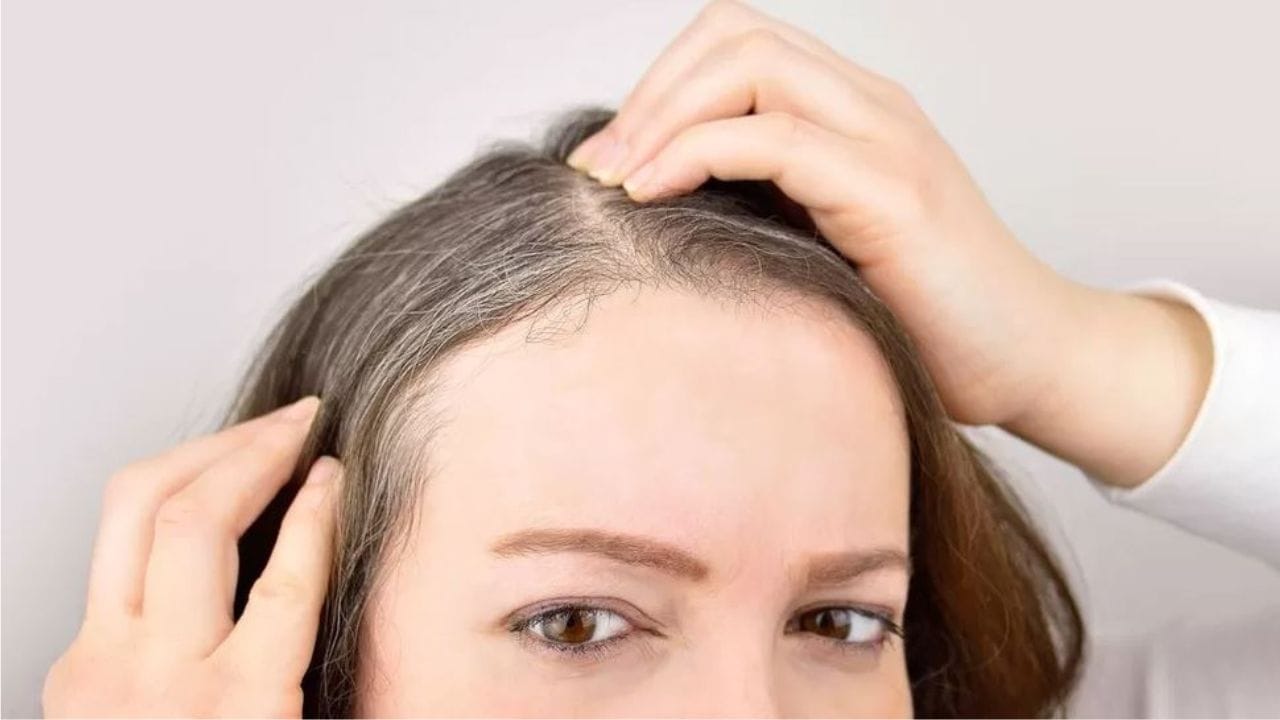 White Hair: ನ್ಯೂಯಾರ್ಕ್ ಅಧ್ಯಯನಗಳು ಹೇಳುತ್ತಿವೆ ಬಿಳಿ ಕೂದಲಿಗೆ ಅಸಲಿ ಕಾರಣಗಳು ಇವೇ ಅಂತೆ! White Hair: ನ್ಯೂಯಾರ್ಕ್ ಅಧ್ಯಯನಗಳು ಹೇಳುತ್ತಿವೆ ಬಿಳಿ ಕೂದಲಿಗೆ ಅಸಲಿ ಕಾರಣಗಳು ಇವೇ ಅಂತೆ!