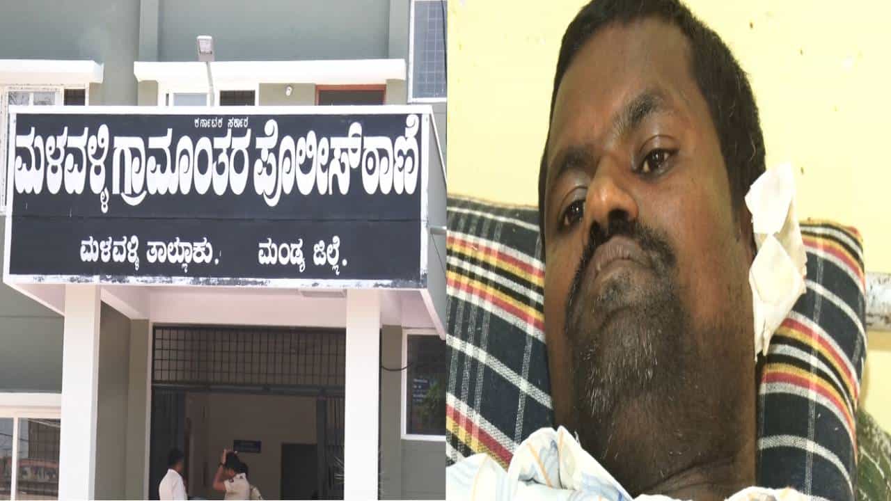 ಮಂಡ್ಯ: ಜೆಡಿಎಸ್ ಶಾಸಕನ ವಿರುದ್ದ ಪೋಸ್ಟ್ ಮಾಡಿದಕ್ಕೆ ಕಾಂಗ್ರೆಸ್ ಕಾರ್ಯಕರ್ತನ ಕಿವಿ ಕಟ್; ಏನಿದು ಕಥೆ ಅಂತೀರಾ? ಈ ಸ್ಟೋರಿ ನೋಡಿ ಮಂಡ್ಯ: ಜೆಡಿಎಸ್ ಶಾಸಕನ ವಿರುದ್ದ ಪೋಸ್ಟ್ ಮಾಡಿದಕ್ಕೆ ಕಾಂಗ್ರೆಸ್ ಕಾರ್ಯಕರ್ತನ ಕಿವಿ ಕಟ್; ಏನಿದು ಕಥೆ ಅಂತೀರಾ? ಈ ಸ್ಟೋರಿ ನೋಡಿ