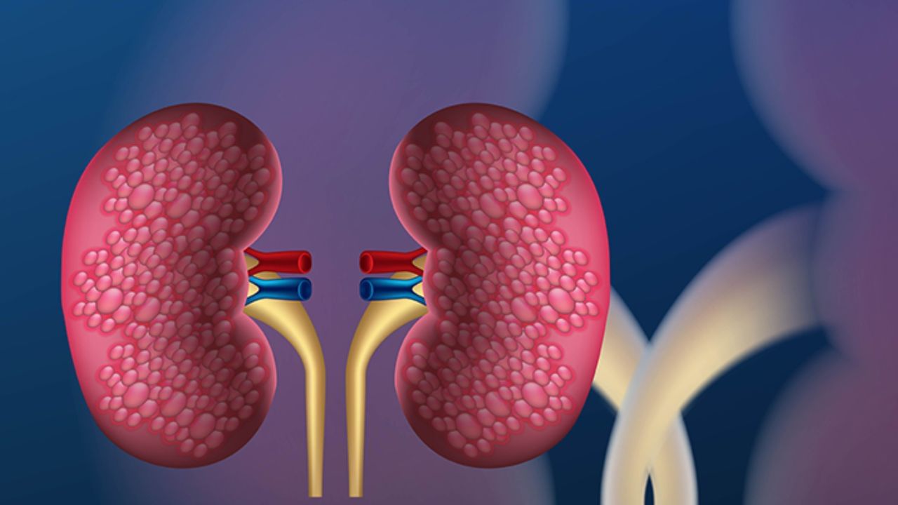 Diabetic Kidney: ಮಧುಮೇಹದ ಮೂತ್ರಪಿಂಡ ಕಾಯಿಲೆಯ ಎಚ್ಚರಿಕೆ ಹಂತಗಳು