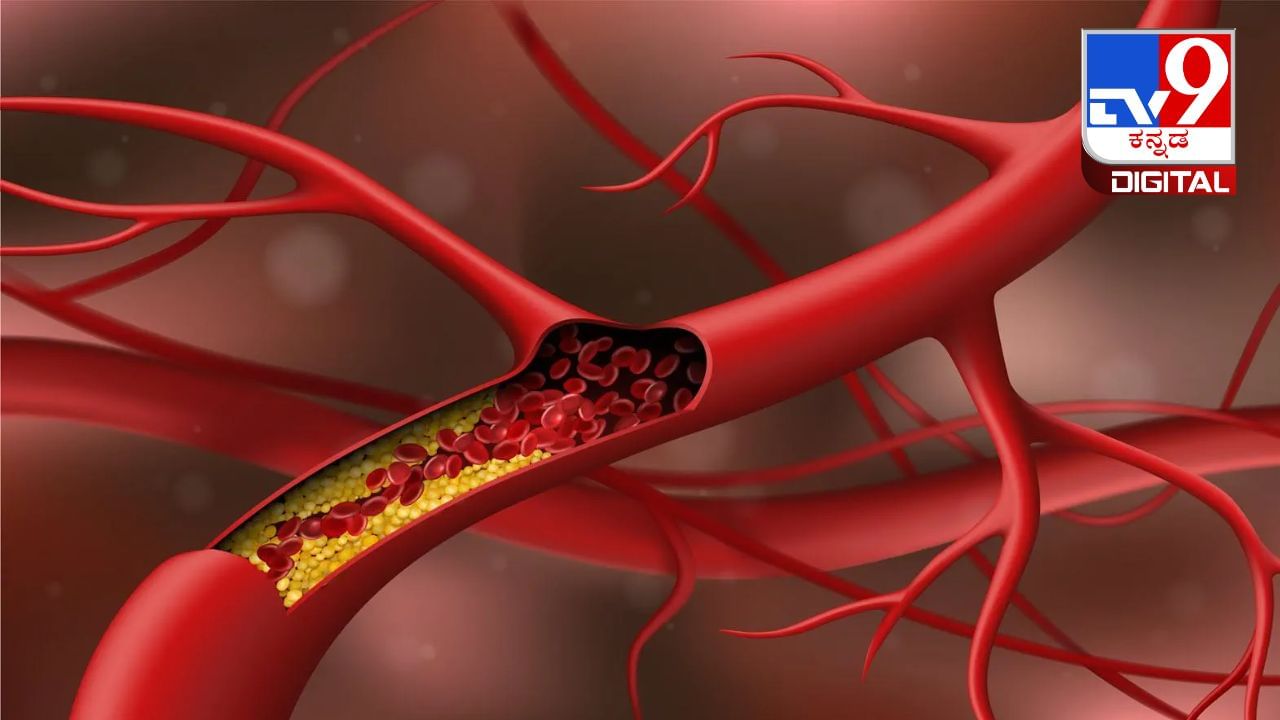 Cholesterol: ಕೊಲೆಸ್ಟ್ರಾಲ್ ಕಡಿಮೆ ಮಾಡಲು ಸಹಾಯ ಮಾಡುವ 5 ಆಹಾರಗಳು Cholesterol: ಕೊಲೆಸ್ಟ್ರಾಲ್ ಕಡಿಮೆ ಮಾಡಲು ಸಹಾಯ ಮಾಡುವ 5 ಆಹಾರಗಳು