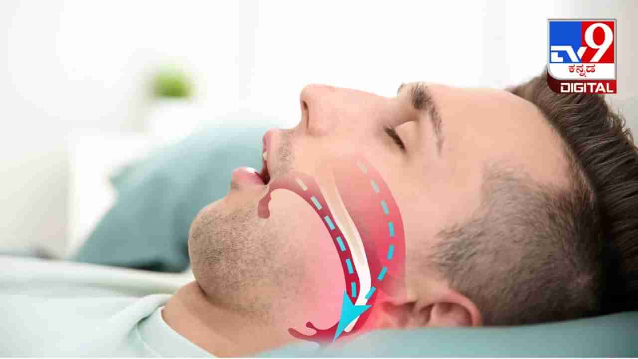 Sleep Apnea: ಹಗಲಿನಲ್ಲಿ ಅತಿಯಾದ ನಿದ್ರೆ ಮಾಡುವವರಿಗೆ ಸೂಕ್ತ ಚಿಕಿತ್ಸೆ: ಇಲ್ಲಿದೆ ಸಂಶೋಧನ ಮಾಹಿತಿ