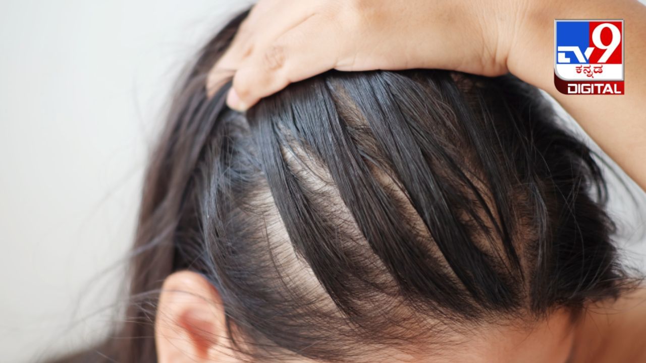 Hair Care Tips: ಕೂದಲು ತೆಳುವಾಗುತ್ತಿದೆಯಾ? ಆರೈಕೆಗೆ ಏನು ಮಾಡಬೇಕು? ಯಾವ ಗಿಡಮೂಲಿಕೆಗಳನ್ನು ಬಳಸಬೇಕು ಇಲ್ಲಿದೆ ಮಾಹಿತಿ Hair Care Tips: ಕೂದಲು ತೆಳುವಾಗುತ್ತಿದೆಯಾ? ಆರೈಕೆಗೆ ಏನು ಮಾಡಬೇಕು? ಯಾವ ಗಿಡಮೂಲಿಕೆಗಳನ್ನು ಬಳಸಬೇಕು ಇಲ್ಲಿದೆ ಮಾಹಿತಿ