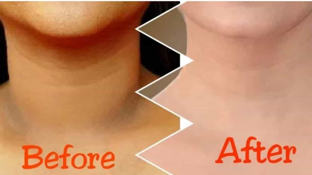 Dark Neck: ಕತ್ತು ದೇಹದ ಸುಂದರ ಭಾಗ, ಅದೇ ಕೊಳೆಗಟ್ಟಿದರೆ ಹೇಗೆ? ಆಯ್ತು ಹೋಗಲಾಡಿಸುವುದು ಹೇಗೆ? ಇಲ್ಲಿದೆ ವಿವರ Dark Neck: ಕತ್ತು ದೇಹದ ಸುಂದರ ಭಾಗ, ಅದೇ ಕೊಳೆಗಟ್ಟಿದರೆ ಹೇಗೆ? ಆಯ್ತು ಹೋಗಲಾಡಿಸುವುದು ಹೇಗೆ? ಇಲ್ಲಿದೆ ವಿವರ