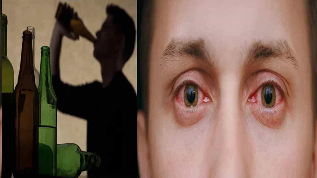 Alcohol: ಮದ್ಯ ಸೇವಿಸುವವರ ಕಣ್ಣು ಕೆಂಪಾಗುವುದು ಯಾಕೆ? ಇದರ ಹಿಂದಿನ ಕಾರಣ ಏನು? ಇಲ್ಲಿದೆ ಮಾಹಿತಿ Alcohol: ಮದ್ಯ ಸೇವಿಸುವವರ ಕಣ್ಣು ಕೆಂಪಾಗುವುದು ಯಾಕೆ? ಇದರ ಹಿಂದಿನ ಕಾರಣ ಏನು? ಇಲ್ಲಿದೆ ಮಾಹಿತಿ